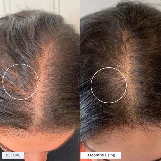 Follica Hair Helper Spray