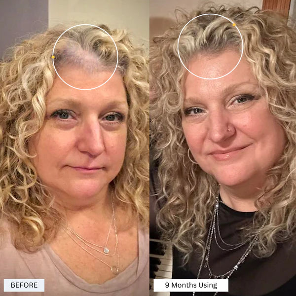 Follica Hair Helper Spray