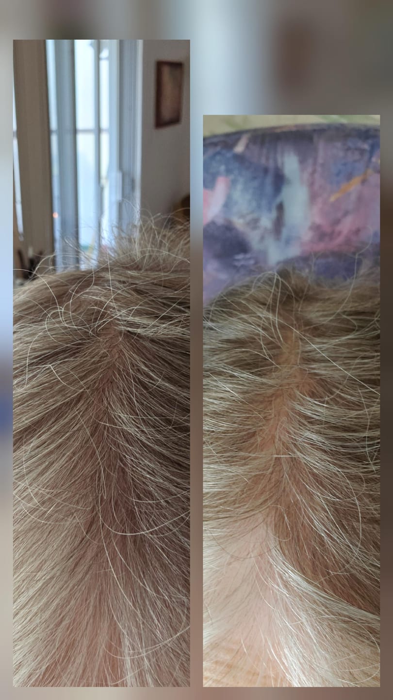 <em>Tracey L., 58</em>