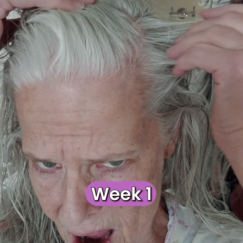 Follica Hair Helper Spray