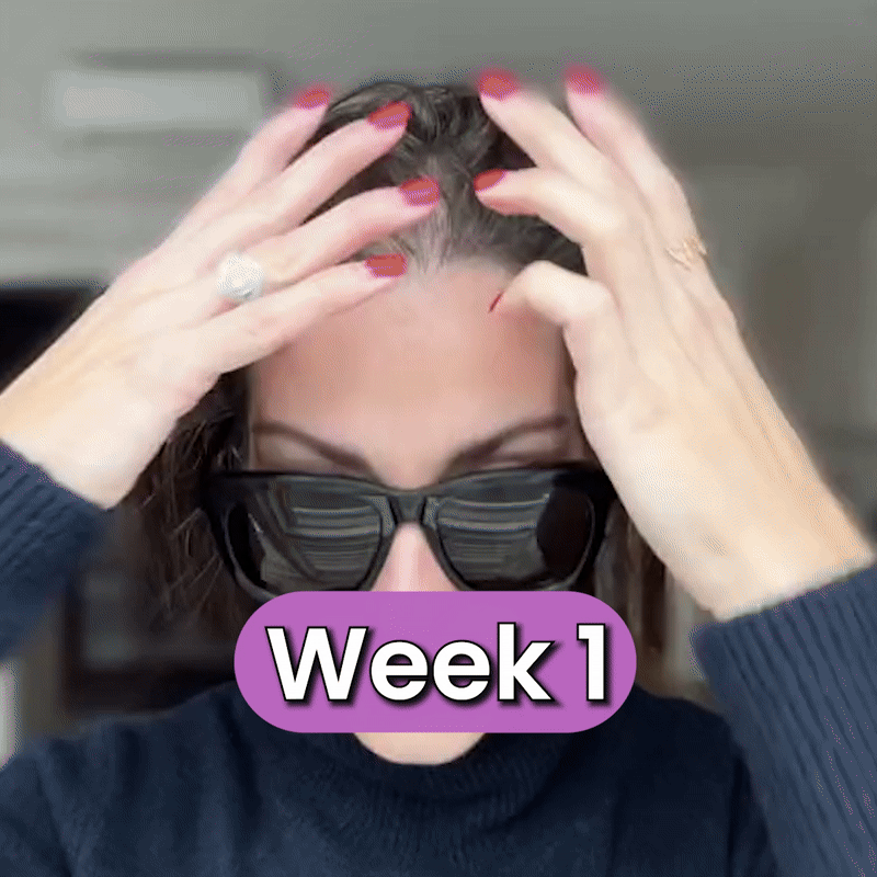 Follica Hair Helper Spray