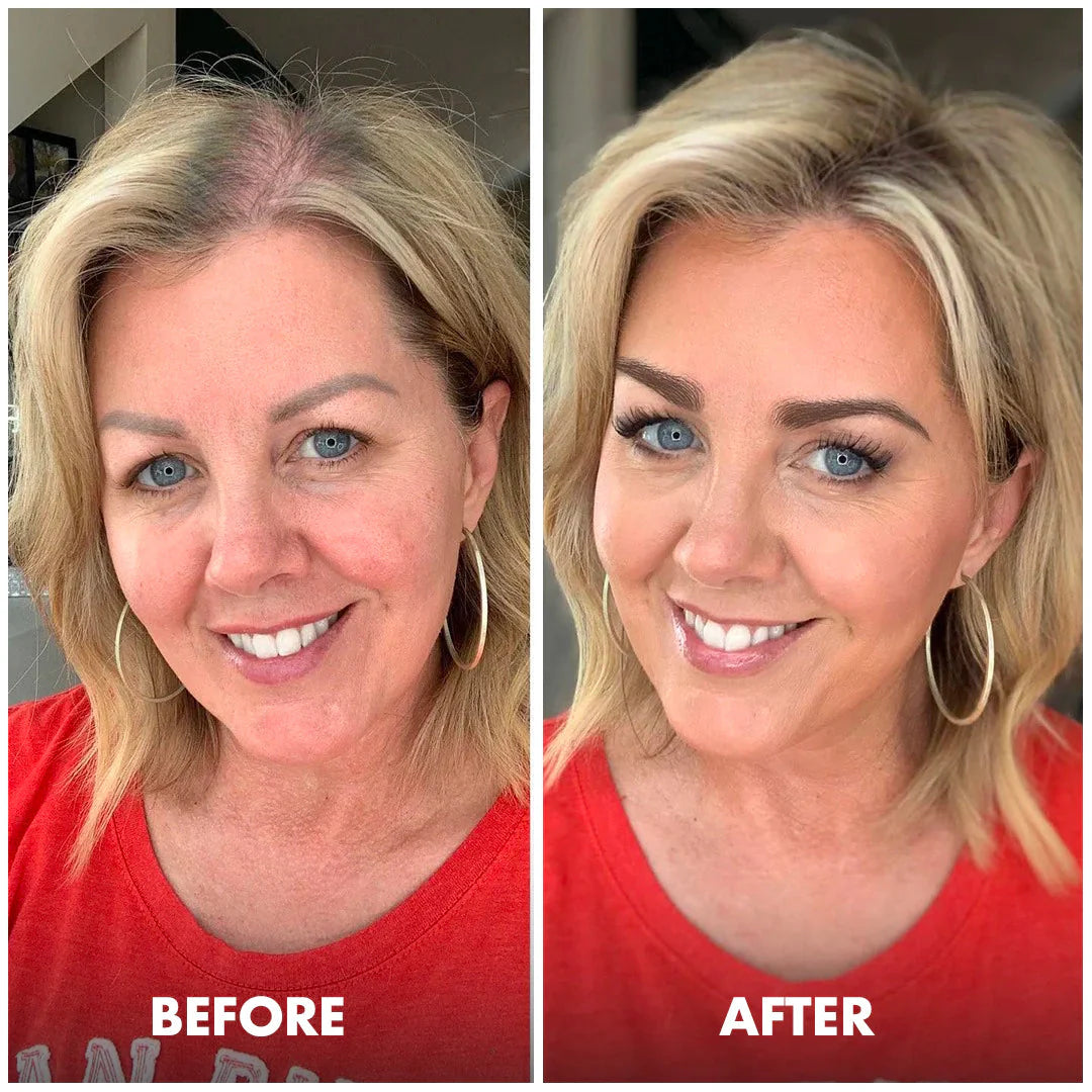 Follica Hair Helper Spray