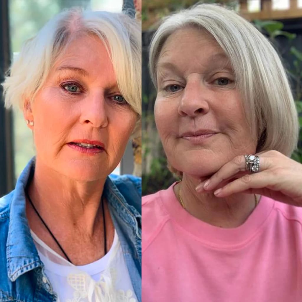 Follica Hair Helper Spray